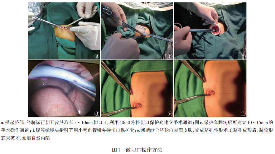 微切口单孔腹腔镜妇科手术现状与进展