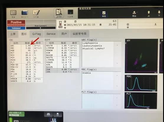 一切正常，唯独白细胞危急值，离谱！