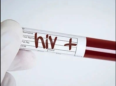 这个HIV结果该怎么报？