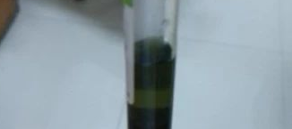  一例罕见的墨绿色血浆