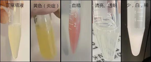是色香味，还是高富帅？关于精子，原来还能有这种操作！