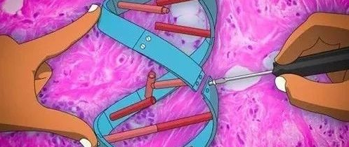 振奋！世界首例体内CRISPR基因编辑临床试验结果公布