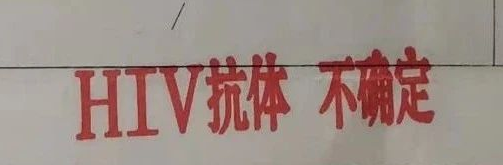 HIV抗体【不确定】-让人纠结的疾控确证报告结果