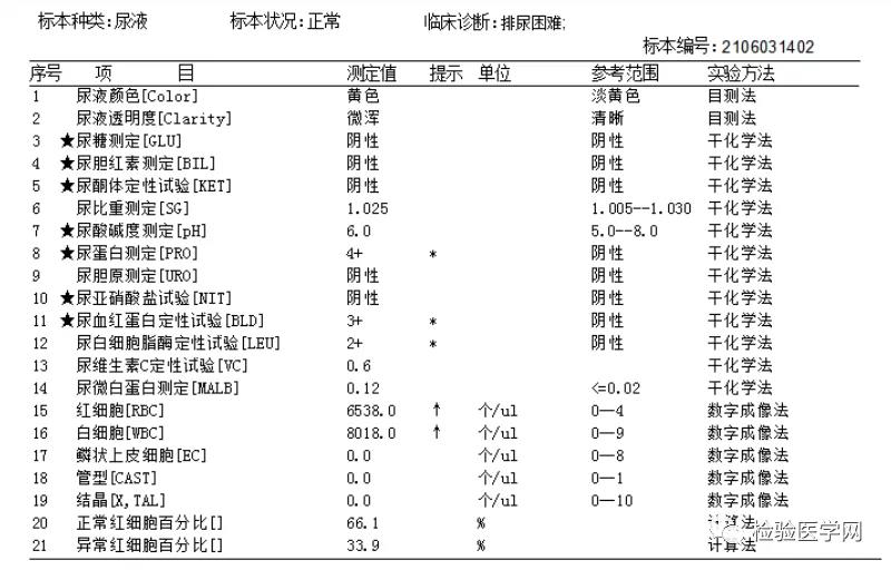 老方法，新挑战——尿液标本中“惊现”肿瘤细胞！