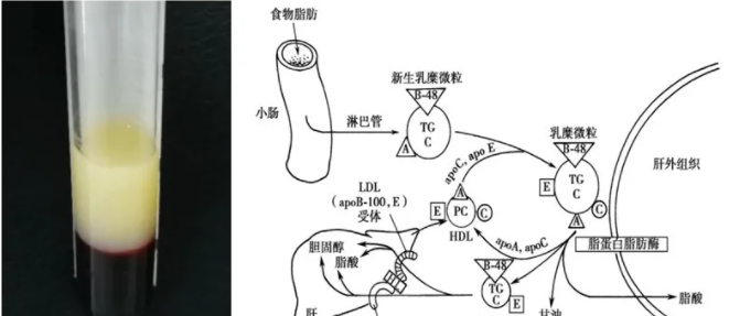 拿什么拯救你？血常规检测的死对头——乳糜血