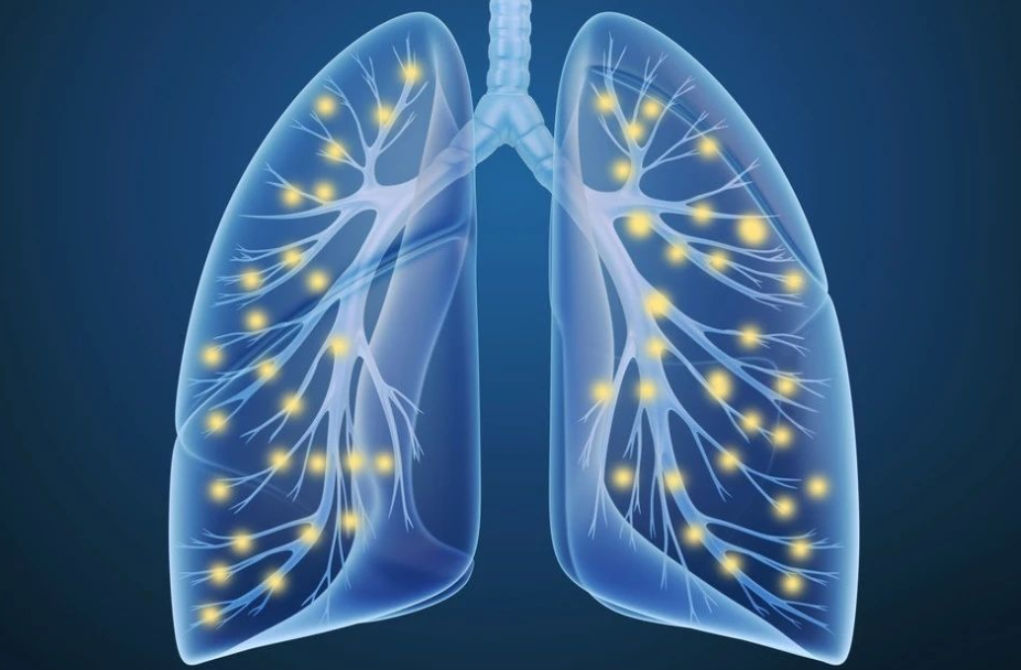  呼吸道感染常见病毒与检测方案精析(下)