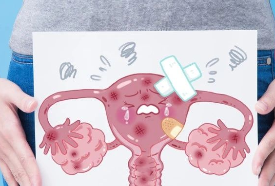  备孕遇上子宫肌瘤，先手术还是先怀孕？