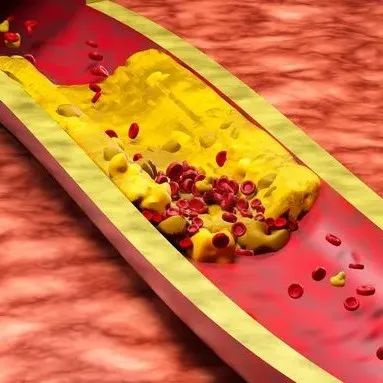 脂蛋白转运的血脂是否为人体所需物质？