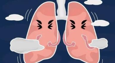  肺气肿会引起肺癌吗？