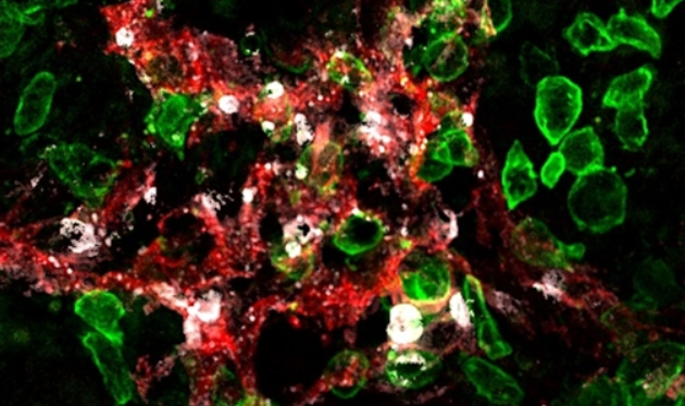 最新发现 | 防止癌细胞的转移，杀手T细胞有双重优势