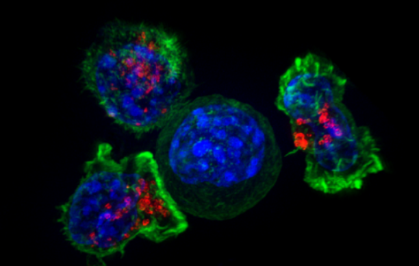 中国专家获得CAR-T细胞治疗研究新成果：能安全有效治疗妇科肿瘤等