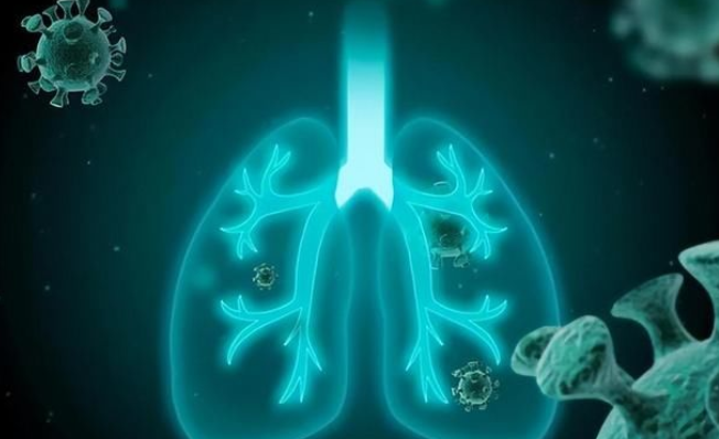 专家解答： “白肺”是什么？甲流可能引起“白肺”吗？