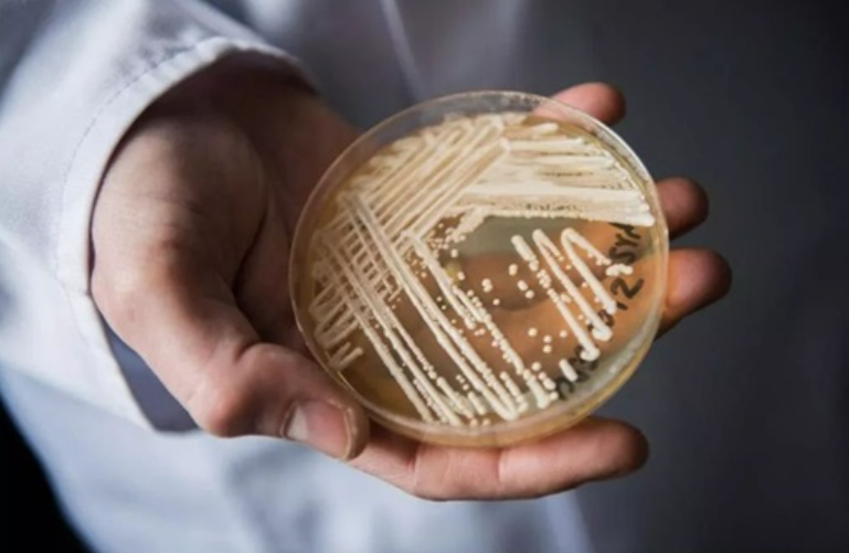 注意！“超级真菌”传播速度惊人！近半感染者90天内死亡！