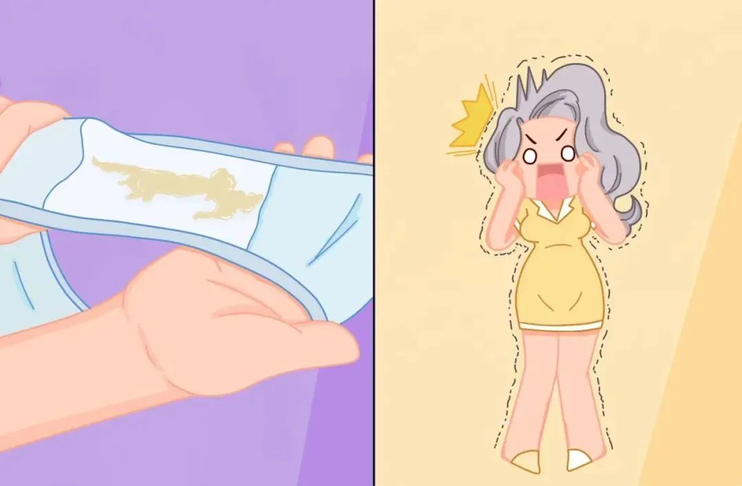 白带常规知识知多少
