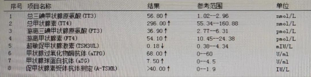 甲减患者TRAb升高，为什么？