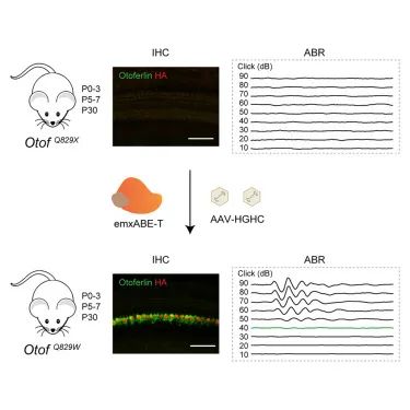新型基因编辑工具成功实现遗传性耳聋DFNB9基因治疗