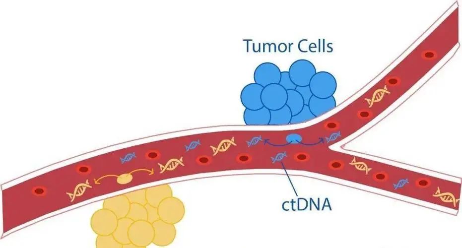 ctDNA检测有助于指导癌症治疗的临床决策