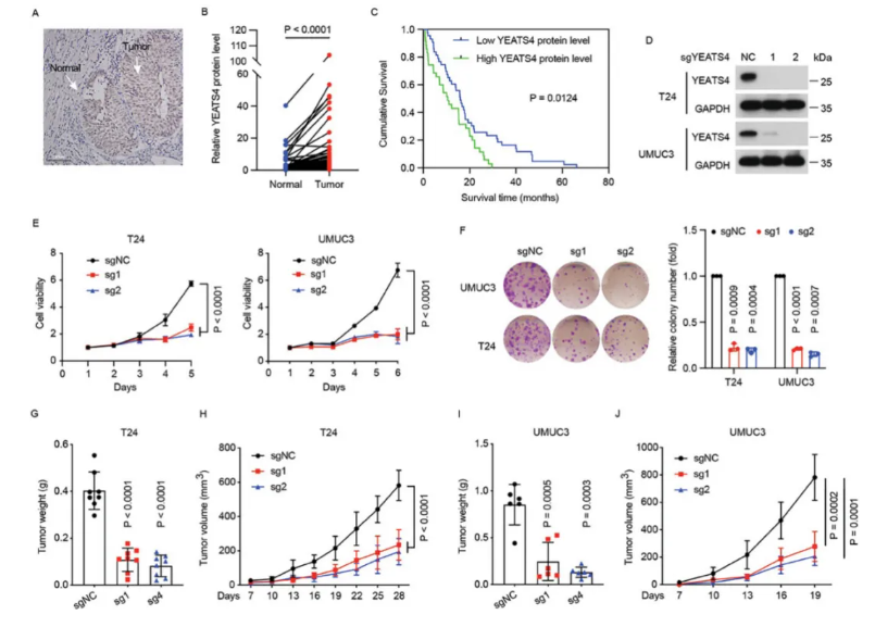 发现靶向KAT8/YEATS4轴抑制肿瘤生长并增加膀胱癌对顺铂的敏感性