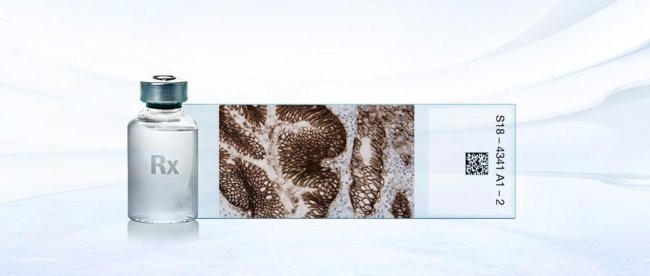 中国首个！威络益伴随诊断试剂(CLDN18) 重磅获批